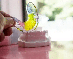 Colorful retainer model displayed on dental model showing tooth retention treatment options.