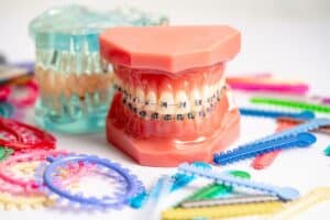 Orthodontic Treatment for adults